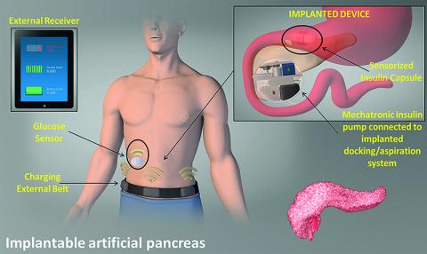Image for img1_bis_-_implantable_bionic_organs.jpg